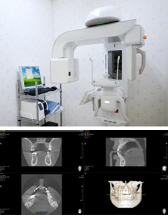 CTレントゲン画像